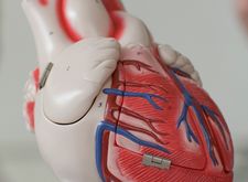 ein plastisches Modell eines Herzens